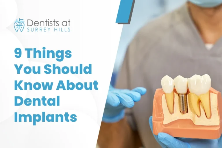 Things you should know about dental implants