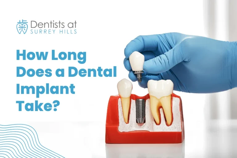 How long does a dental implant takes?