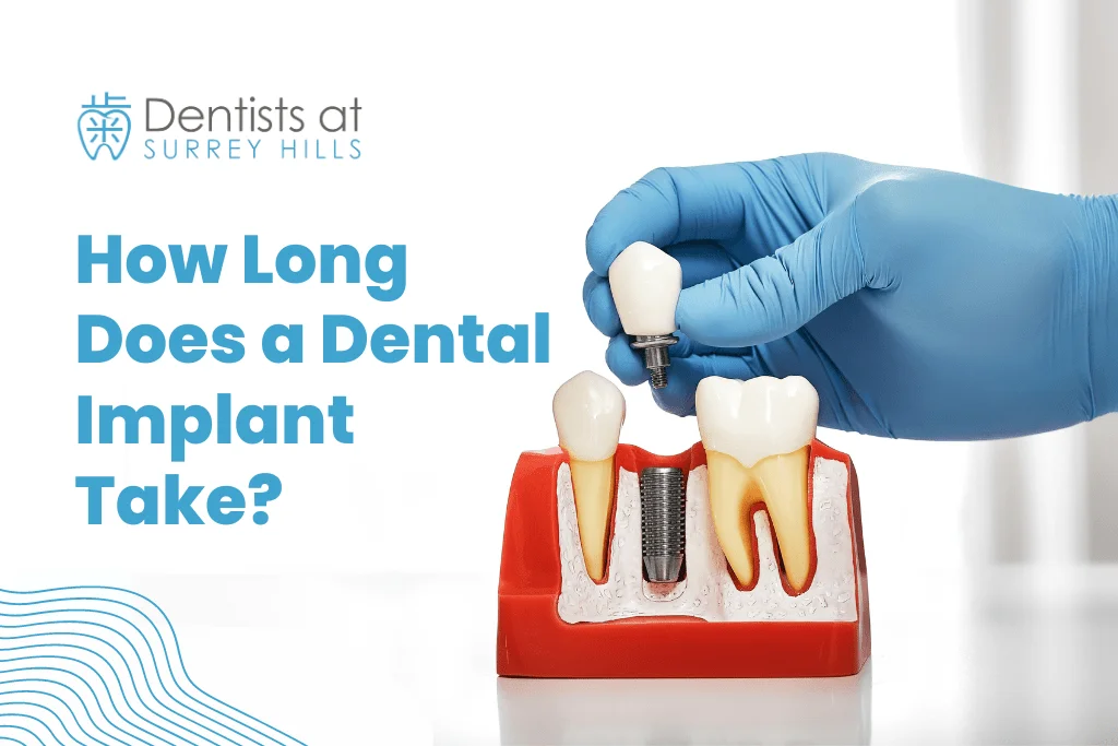 How long does a dental implant takes?