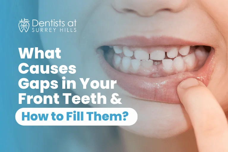 what causes gap in your teeths.