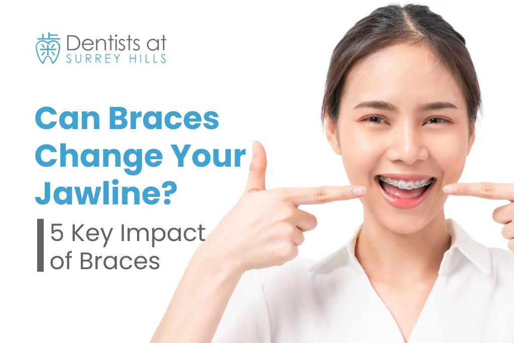 can braces change your jawline