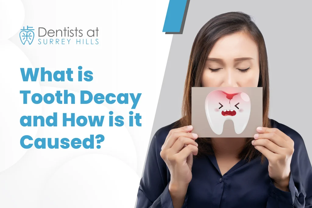 tooth decay
