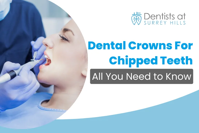 Dental Crowns For Chipped Teeth
