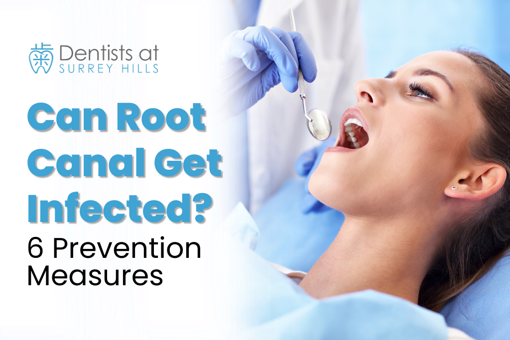 Can Root Canal Get Infected