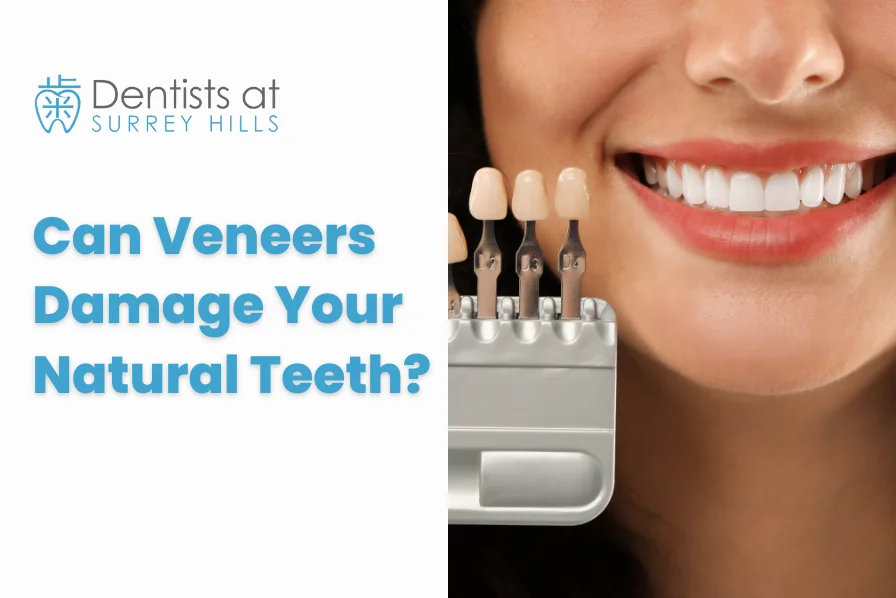 Can Veneers Damage Your Natural Teeth? What You Should Know