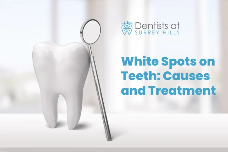 White Spots on Teeth Causes and Treatment