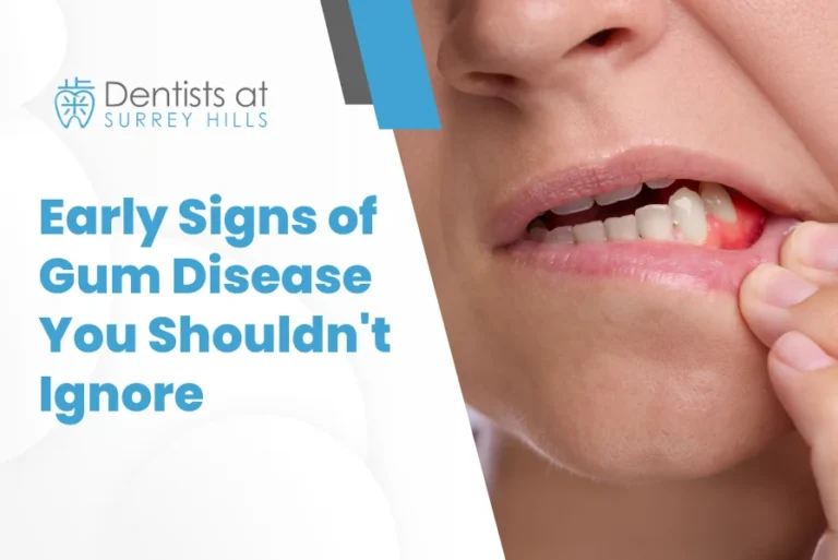 Early Signs of Gum Disease You Shouldn't Ignore