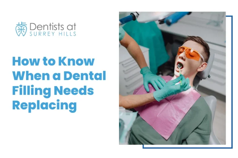 How to Know When a Dental Filling Needs Replacing