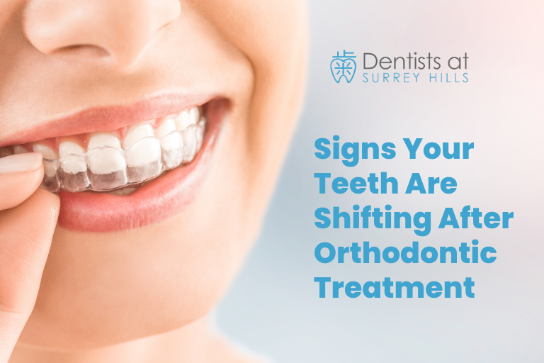 Signs Your Teeth Are Shifting After Orthodontic Treatment