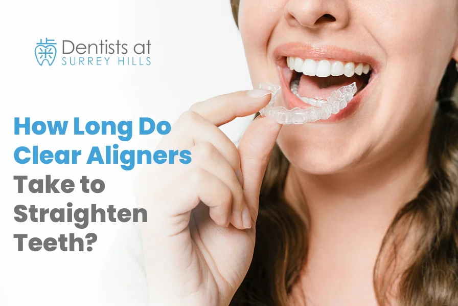How Long Do Clear Aligners Take to Straighten Teeth