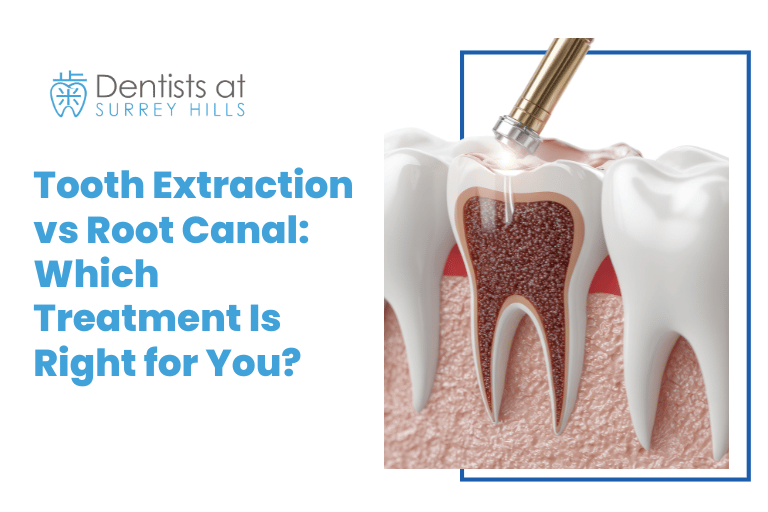 Tooth Extraction vs Root Canal Which Treatment Is Right for You