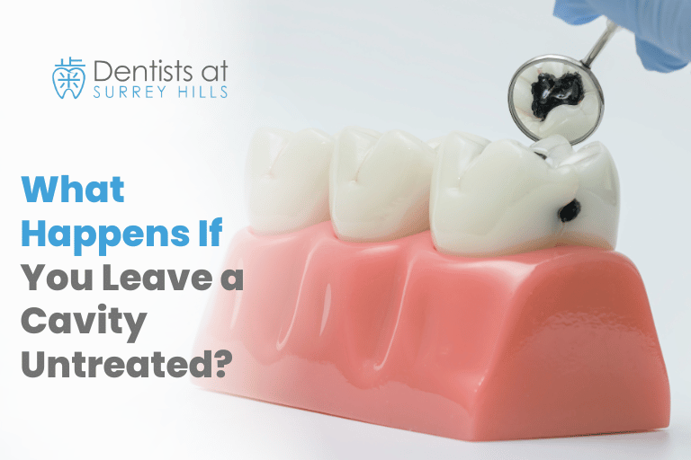 What Happens If You Leave a Cavity Untreated